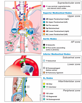 What lymph nodes are captured in Node Analysis (See Clinical ...